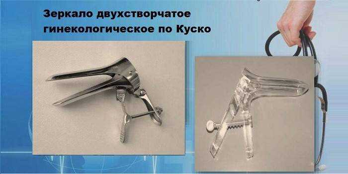 Осмотр гинекологическим зеркалом